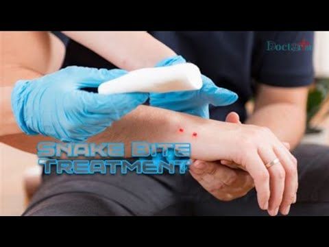 Is Calcium Gluconate the Cure for Snake Bites?