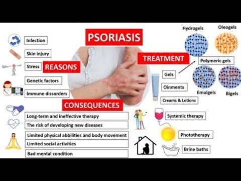 The Psoriasis Problem: Understanding Causes & Treatments